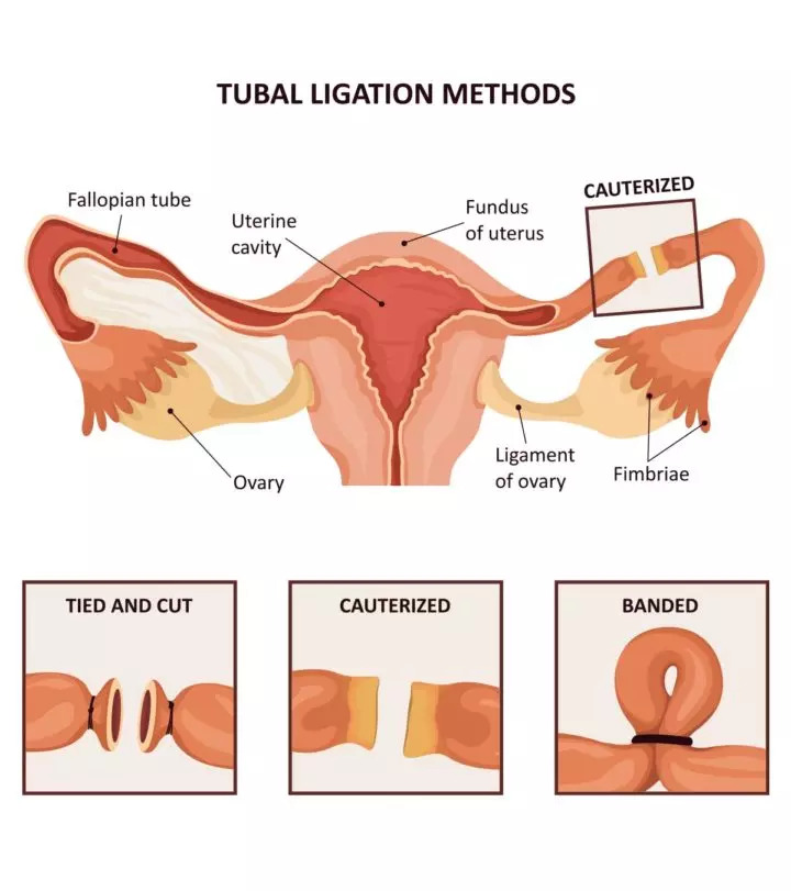 What Are The Different Methods Of Contraception Class 10th CBSE 