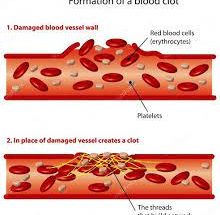 Process of Blood Clotting﻿ by platelets