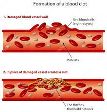 Process of Blood Clotting﻿ by platelets