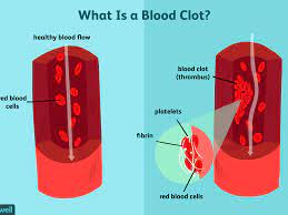 What is the Process Of Blood Clotting ?﻿