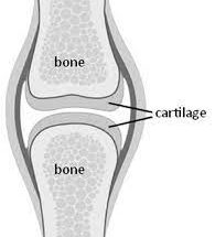 Differentiate between Bone and Cartilage with respect to Structure Functions and Location.