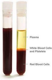 22 Differences Between Plasma and Serum - plasma