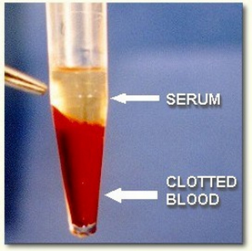 22 Differences Between Plasma and Serum - Serum 