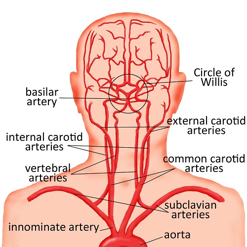 Arteries of the body 