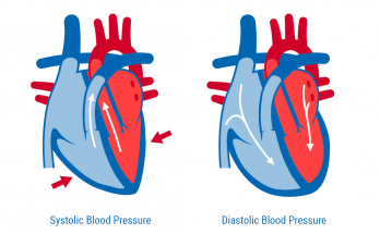 Systolic and Diastolic Blood Pressure